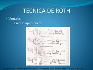 TECNICA DE ROTH
 Ventajas
12. En casos quirúrgicos
Five Year Clinical Evaluation of the ANDREWS STRAIGHT WIRE APPLIANCE. Ronald H. Rothh, DDS, Ms.JCO. Nov,1976
 