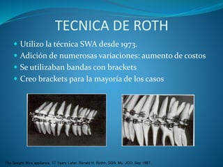 TECNICA DE ROTH
 Utilizo la técnica SWA desde 1973.
 Adición de numerosas variaciones: aumento de costos
 Se utilizaban bandas con brackets
 Creo brackets para la mayoría de los casos
The Sraight Wire appliance, 17 Years Later. Ronald H. Rothh, DDS, Ms. JCO, Sep 1987.
 