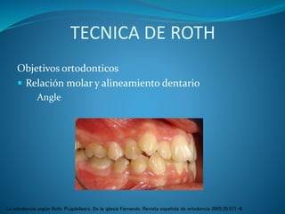 TECNICA DE ROTH
Objetivos ortodonticos
 Relación molar y alineamiento dentario
 Angle
La ortodoncia según Roth. Puigdolleers, De la iglesia Fernando. Revista española de ortodoncia 2005;35:371-6
 