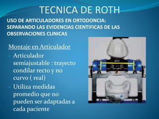 USO DE ARTICULADORES EN ORTODONCIA:
SEPARANDO LAS EVIDENCIAS CIENTIFICAS DE LAS
OBSERVACIONES CLINICAS
Montaje en Articulador
- Articulador
semiajustable : trayecto
condilar recto y no
curvo ( real)
- Utiliza medidas
promedio que no
pueden ser adaptadas a
cada paciente
TECNICA DE ROTH
 