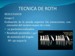 TECNICA DE ROTH
RESULTADOS
Grupo C
Evaluación de la arcada superior sin extracciones, con
extrusión del incisivo mayor de 2 mm
 24 pacientes evaluados.
 Resultado promedio 1.342°
de aumento del ángulo
PP- eje mayor Is
 