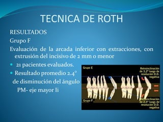 TECNICA DE ROTH
RESULTADOS
Grupo F
Evaluación de la arcada inferior con extracciones, con
extrusión del incisivo de 2 mm o menor
 21 pacientes evaluados.
 Resultado promedio 2.4°
de disminución del ángulo
PM- eje mayor Ii
 