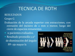 TECNICA DE ROTH
RESULTADOS
Grupo G
Evaluación de la arcada superior con extracciones, con
extrusión del incisivo de 2 mm o menor, luego del
cierre de espacios remanentes
 11 pacientes evaluados.
 Resultado promedio 1.11°
de disminución del ángulo
PP- eje mayor Is
 