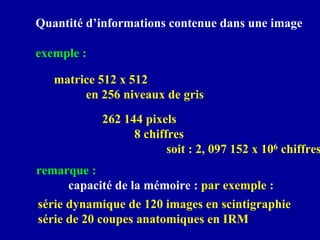 Quantité d’informations contenue dans une image
exemple :
matrice 512 x 512
en 256 niveaux de gris
262 144 pixels
8 chiffres
soit : 2, 097 152 x 106 chiffres
remarque :
capacité de la mémoire : par exemple :
série dynamique de 120 images en scintigraphie
série de 20 coupes anatomiques en IRM
 