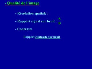 - Résolution spatiale :
- Rapport signal sur bruit :
S
B
- Qualité de l’image
- Contraste
Rapport contraste sur bruit
 