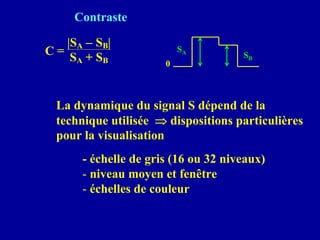 Contraste
SA
SB
0
C =
|SA − SB|
SA + SB
La dynamique du signal S dépend de la
technique utilisée ⇒ dispositions particulières
pour la visualisation
- échelle de gris (16 ou 32 niveaux)
- niveau moyen et fenêtre
- échelles de couleur
 