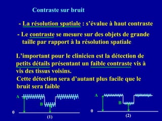Contraste sur bruit
- La résolution spatiale : s’évalue à haut contraste
- Le contraste se mesure sur des objets de grande
taille par rapport à la résolution spatiale
L’important pour le clinicien est la détection de
petits détails présentant un faible contraste vis à
vis des tissus voisins.
Cette détection sera d’autant plus facile que le
bruit sera faible
(1)
A
0
B
(2)
A
0
B
 