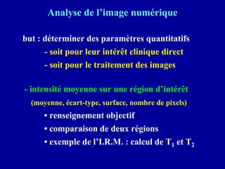Analyse de l’image numérique
but : déterminer des paramètres quantitatifs
- soit pour leur intérêt clinique direct
- soit pour le traitement des images
- intensité moyenne sur une région d’intérêt
(moyenne, écart-type, surface, nombre de pixels)
• renseignement objectif
• comparaison de deux régions
• exemple de l’I.R.M. : calcul de T1 et T2
 