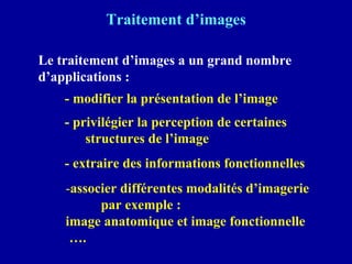 Traitement d’images
Le traitement d’images a un grand nombre
d’applications :
- modifier la présentation de l’image
- privilégier la perception de certaines
structures de l’image
- extraire des informations fonctionnelles
-associer différentes modalités d’imagerie
par exemple :
image anatomique et image fonctionnelle
….
 