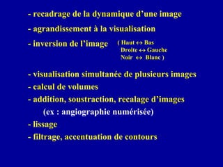 - recadrage de la dynamique d’une image
- inversion de l’image ( Haut ↔ Bas
Droite ↔ Gauche
Noir ↔ Blanc )
- visualisation simultanée de plusieurs images
- calcul de volumes
- addition, soustraction, recalage d’images
(ex : angiographie numérisée)
- lissage
- filtrage, accentuation de contours
- agrandissement à la visualisation
 