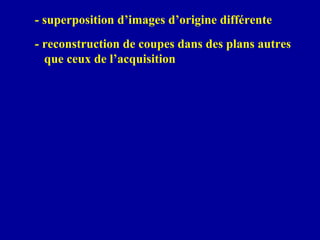 - superposition d’images d’origine différente
- reconstruction de coupes dans des plans autres
que ceux de l’acquisition
 