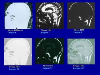 Niveau 1028 (u.a.)
Largeur 1
Niveau 1102
Largeur 1
Niveau 1158
Largeur 1
Niveau 1014
Largeur 74
Niveau 1141
Largeur 74
Niveau 1102
Largeur 619
 