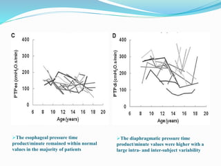 Respiratory Muscle Decline in Duchenne Muscular Dystrophy (2) | PPTX