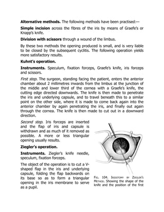 Fig. 104. Iridotomy by Ziegler’s
Method. Showing the shape of the
knife and the position of the first
Alternative methods. The following methods have been practised:—
Simple incision across the fibres of the iris by means of Graefe’s or
Knapp’s knife.
Division with scissors through a wound of the limbus.
By these two methods the opening produced is small, and is very liable
to be closed by the subsequent cyclitis. The following operation yields
more satisfactory results.
Kuhnt’s operation.
Instruments. Speculum, fixation forceps, Graefe’s knife, iris forceps
and scissors.
First step. The surgeon, standing facing the patient, enters the anterior
chamber about 2 millimetres inwards from the limbus at the junction of
the middle and lower third of the cornea with a Graefe’s knife, the
cutting edge directed downwards. The knife is then made to penetrate
the iris and underlying capsule, and to travel beneath this to a similar
point on the other side, where it is made to come back again into the
anterior chamber by again penetrating the iris, and finally out again
through the cornea. The knife is then made to cut out in a downward
direction.
Second step. Iris forceps are inserted
and the flap of iris and capsule is
withdrawn and as much of it removed as
possible. A more or less triangular
opening usually results.
Ziegler’s operation.
Instruments. Ziegler’s knife needle,
speculum, fixation forceps.
The object of the operation is to cut a V-
shaped flap in the iris and underlying
capsule, folding the flap backwards on
its base so as to form a triangular
opening in the iris membrane to serve
as a pupil.
 