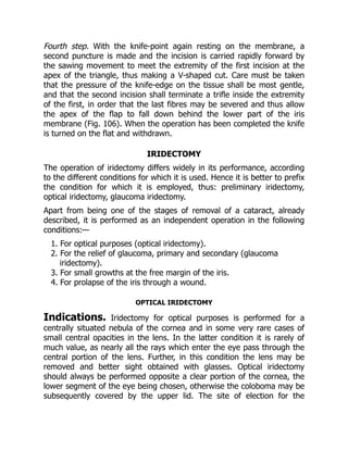Fourth step. With the knife-point again resting on the membrane, a
second puncture is made and the incision is carried rapidly forward by
the sawing movement to meet the extremity of the first incision at the
apex of the triangle, thus making a V-shaped cut. Care must be taken
that the pressure of the knife-edge on the tissue shall be most gentle,
and that the second incision shall terminate a trifle inside the extremity
of the first, in order that the last fibres may be severed and thus allow
the apex of the flap to fall down behind the lower part of the iris
membrane (Fig. 106). When the operation has been completed the knife
is turned on the flat and withdrawn.
IRIDECTOMY
The operation of iridectomy differs widely in its performance, according
to the different conditions for which it is used. Hence it is better to prefix
the condition for which it is employed, thus: preliminary iridectomy,
optical iridectomy, glaucoma iridectomy.
Apart from being one of the stages of removal of a cataract, already
described, it is performed as an independent operation in the following
conditions:—
1. For optical purposes (optical iridectomy).
2. For the relief of glaucoma, primary and secondary (glaucoma
iridectomy).
3. For small growths at the free margin of the iris.
4. For prolapse of the iris through a wound.
OPTICAL IRIDECTOMY
Indications. Iridectomy for optical purposes is performed for a
centrally situated nebula of the cornea and in some very rare cases of
small central opacities in the lens. In the latter condition it is rarely of
much value, as nearly all the rays which enter the eye pass through the
central portion of the lens. Further, in this condition the lens may be
removed and better sight obtained with glasses. Optical iridectomy
should always be performed opposite a clear portion of the cornea, the
lower segment of the eye being chosen, otherwise the coloboma may be
subsequently covered by the upper lid. The site of election for the
 