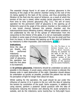 Fig. 111. The Angle of the
Anterior Chamber from a
Case of Recent Glaucoma.
Showing its occlusion by
the base of the iris, a,
being adherent to the
posterior surface of the
cornea, so preventing
filtration of the aqueous
into the canal of Schlemm,
b.
The essential change found in all cases of primary glaucoma is the
blocking of the angle of the anterior chamber owing to the root of the
iris being applied to the back of the cornea, and thus preventing the
filtration of the fluid into the canal of Schlemm, as a result of which the
tension of the eye is raised, either acutely (acute glaucoma) or slowly
from time to time (chronic glaucoma) (Fig. 111). The aim of every
operation for the permanent relief of glaucoma is the opening up of
Schlemm’s canal at the angle of the anterior chamber or the creation of
a new lymph channel between the anterior chamber and the
subconjunctival tissue (filtrating cicatrix). Although this latter condition is
not unattended by the risk of the spread of inflammation from the
conjunctiva to the interior of the globe, it is not an inadvisable condition
to obtain in some cases of chronic glaucoma if the scar be small and free
from iris tissue; in this disease the opening up of the canal of Schlemm
by iridectomy is often impossible. (See Sclerectomy, p. 231.)
Indications.
Since the days of
von Graefe, who
first performed
iridectomy
empirically for the
relief of glaucoma,
the operation has
held the first place
in its treatment.
(i) In primary glaucoma. Iridectomy should be undertaken as early as
possible in the disease. In acute cases, unless the tension is relieved, the
disease ends in rapid destruction of the sight. Operation should always
be undertaken as quickly as possible, provided the patient has not lost
his perception of light for longer than about ten days.
Whilst waiting for the operation, the pupil should be put under the
influence of eserine (2 to 4 grains to the oz.) with the idea of reducing
the tension by contraction of the pupil. Some surgeons, in addition to
using eserine, perform a posterior scleral puncture with the idea of
temporarily reducing the tension and allowing the acute symptoms to
subside, and do the iridectomy some twenty-four to forty-eight hours
 