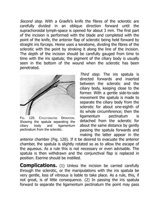 Fig. 120. Cyclo-dialysis Operation.
Showing the spatula separating the
ciliary body and ligamentum
pectinatum from the sclerotic.
Second step. With a Graefe’s knife the fibres of the sclerotic are
carefully divided in an oblique direction forward until the
suprachoroidal lymph-space is opened for about 3 mm. The first part
of the incision is performed with the blade and completed with the
point of the knife, the anterior flap of sclerotic being held forward by
straight iris forceps. Heine uses a keratome, dividing the fibres of the
sclerotic with the point by stroking it along the line of the incision.
The depth of the incision should be carefully gauged from time to
time with the iris spatula; the pigment of the ciliary body is usually
seen in the bottom of the wound when the sclerotic has been
penetrated.
Third step. The iris spatula is
directed forwards and inserted
between the sclerotic and the
ciliary body, keeping close to the
former. With a gentle side-to-side
movement the spatula is made to
separate the ciliary body from the
sclerotic for about one-eighth of
its whole circumference; then the
ligamentum pectinatum is
detached from the sclerotic for
about the same distance by gently
passing the spatula forwards and
making the latter appear in the
anterior chamber (Fig. 120). If it be desired to evacuate the anterior
chamber, the spatula is slightly rotated so as to allow the escape of
the aqueous. As a rule this is not necessary or even advisable. The
spatula is then withdrawn and the conjunctival flap is replaced in
position. Eserine should be instilled.
Complications. (1) Unless the incision be carried carefully
through the sclerotic, or the manipulations with the iris spatula be
very gentle, loss of vitreous is liable to take place. As a rule, this, if
not great, is of little consequence. (2) In passing the iris spatula
forward to separate the ligamentum pectinatum the point may pass
 
