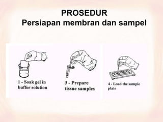 PROSEDUR
Persiapan membran dan sampel
 