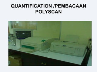 QUANTIFICATION /PEMBACAAN
POLYSCAN
 