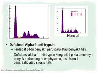 • Defisiensi Alpha-1-anti-trypsin
– Terdapat pada penyakit paru-paru atau penyakit hati.
– Defisiensi alpha-1-anti-trypsin kongenital pada umumnya
banyak berhubungan emphysema, insufisiensi
pancreatic atau sirosis hati.
Normal
http://erl.pathology.iupui.edu/labmed/Generator.cfm?Image=SPE
 