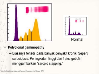 • Polyclonal gammopathy
– Biasanya terjadi pada banyak penyakit kronik. Seperti
sarcoidosis. Peningkatan tinggi dari fraksi gobulin
menggambarkan "sarcoid stepping.”
http://erl.pathology.iupui.edu/labmed/Generator.cfm?Image=SPE
Normal
 