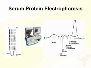 Serum Protein Electrophoresis
 