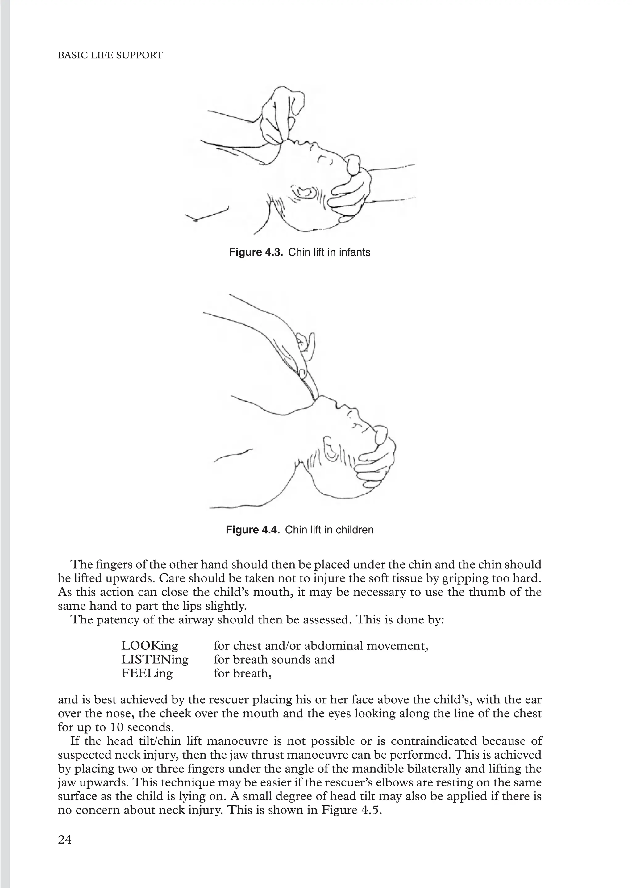 BASIC LIFE SUPPORT
Figure 4.3. Chin lift in infants
Figure 4.4. Chin lift in children
The ﬁngers of the other hand should then be placed under the chin and the chin should
be lifted upwards. Care should be taken not to injure the soft tissue by gripping too hard.
As this action can close the child’s mouth, it may be necessary to use the thumb of the
same hand to part the lips slightly.
The patency of the airway should then be assessed. This is done by:
LOOKing for chest and/or abdominal movement,
LISTENing for breath sounds and
FEELing for breath,
and is best achieved by the rescuer placing his or her face above the child’s, with the ear
over the nose, the cheek over the mouth and the eyes looking along the line of the chest
for up to 10 seconds.
If the head tilt/chin lift manoeuvre is not possible or is contraindicated because of
suspected neck injury, then the jaw thrust manoeuvre can be performed. This is achieved
by placing two or three ﬁngers under the angle of the mandible bilaterally and lifting the
jaw upwards. This technique may be easier if the rescuer’s elbows are resting on the same
surface as the child is lying on. A small degree of head tilt may also be applied if there is
no concern about neck injury. This is shown in Figure 4.5.
24
 