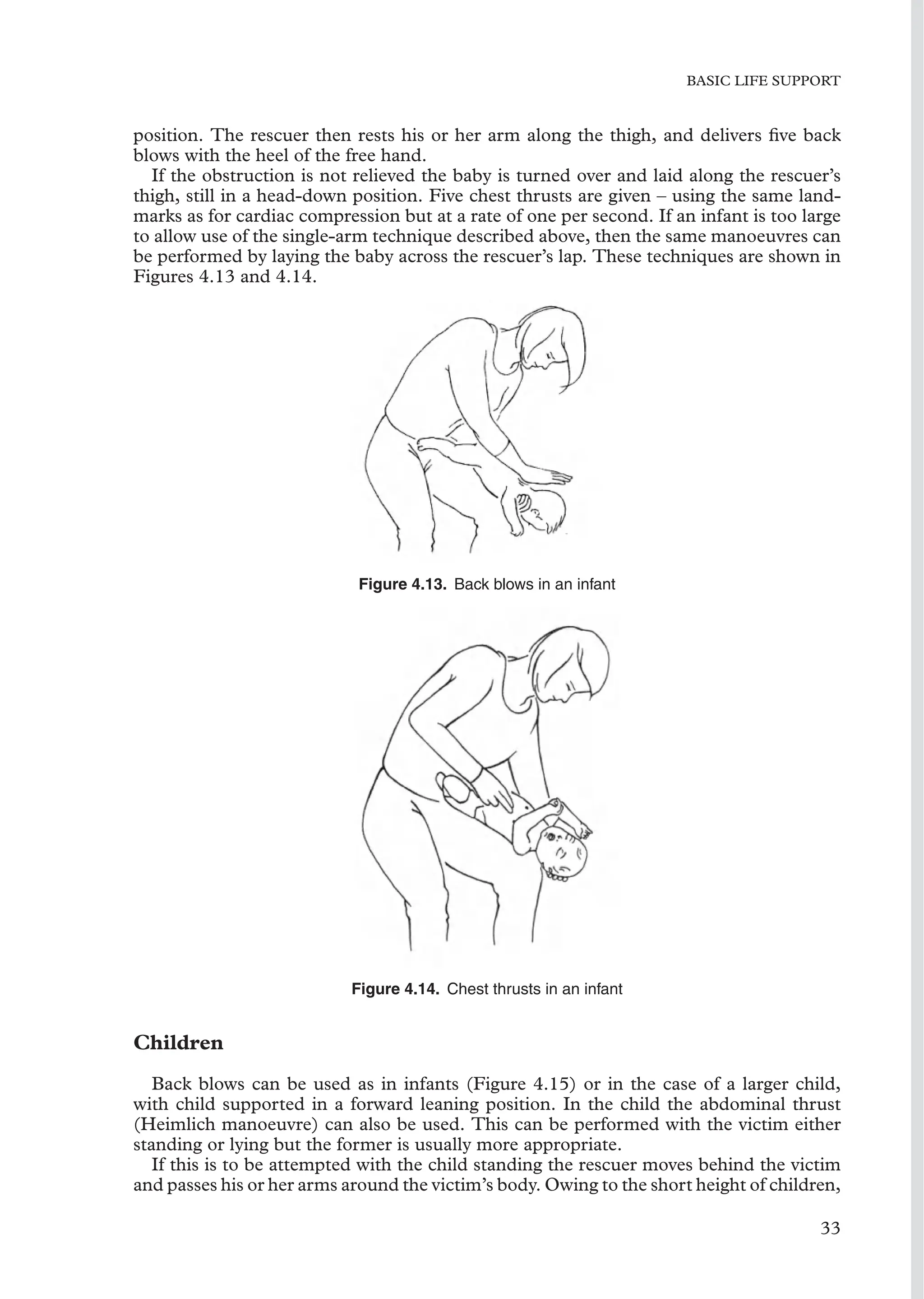 BASIC LIFE SUPPORT
position. The rescuer then rests his or her arm along the thigh, and delivers ﬁve back
blows with the heel of the free hand.
If the obstruction is not relieved the baby is turned over and laid along the rescuer’s
thigh, still in a head-down position. Five chest thrusts are given – using the same land-
marks as for cardiac compression but at a rate of one per second. If an infant is too large
to allow use of the single-arm technique described above, then the same manoeuvres can
be performed by laying the baby across the rescuer’s lap. These techniques are shown in
Figures 4.13 and 4.14.
Figure 4.13. Back blows in an infant
Figure 4.14. Chest thrusts in an infant
Children
Back blows can be used as in infants (Figure 4.15) or in the case of a larger child,
with child supported in a forward leaning position. In the child the abdominal thrust
(Heimlich manoeuvre) can also be used. This can be performed with the victim either
standing or lying but the former is usually more appropriate.
If this is to be attempted with the child standing the rescuer moves behind the victim
and passes his or her arms around the victim’s body. Owing to the short height of children,
33
 