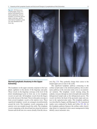 Multimodal Management Of Upper And Lower Extremity Lymphedema Mark V ...