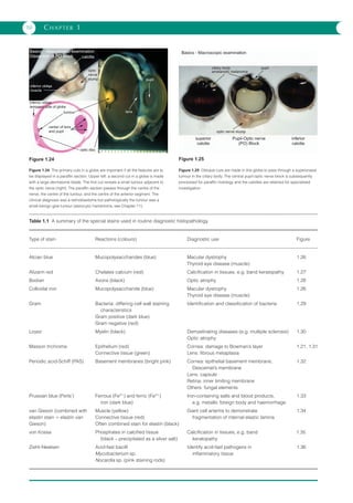 Ophthalmic Pathology An Illustrated Guide For Clinicians K Weng Sehu | PDF