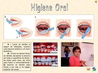 Higiene Oral A –  Lavar os dentes a seguir às refeições, usando uma escova própria e um bom dentífrico. B –  Como se devem lavar os dentes:  a)  passar a escova em toda a superfície do dente, de baixo para cima, de cima para baixo e horizontalmente;  b)  escovar os dentes pela frente e por trás e na região superior da coroa. Depois Antes 