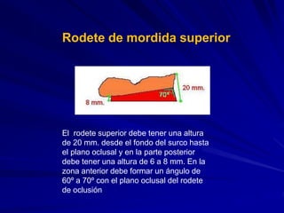 217662639 placa-base-y-rodetes-actual | PPT