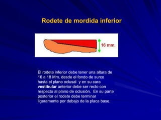 217662639 placa-base-y-rodetes-actual | PPT