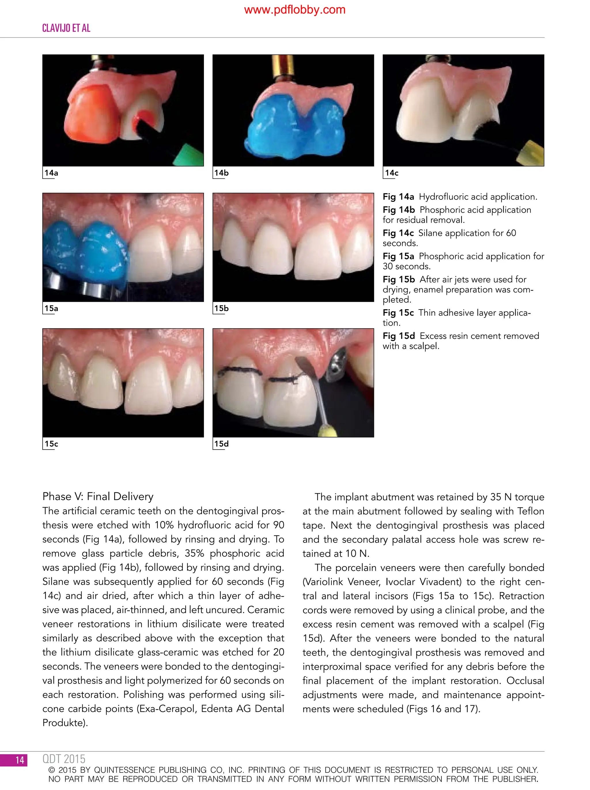 本 Quintessence of Dental Technology2017QDT