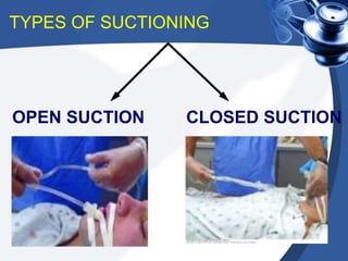 TYPES OF SUCTIONING
OPEN SUCTION CLOSED SUCTION
 