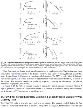 Interpretation Of Pulmonary Function Tests Robert E Hyatt Paul D ...