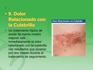 • .
• Un tratamiento tópico de
aceite de menta mostró
mejorar casi
inmediatamente el dolor
relacionado con la culebrilla
con resultados que duraron
por dos meses durante el
tratamiento de seguimiento.
 