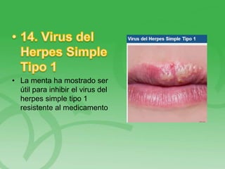 • La menta ha mostrado ser
útil para inhibir el virus del
herpes simple tipo 1
resistente al medicamento
 