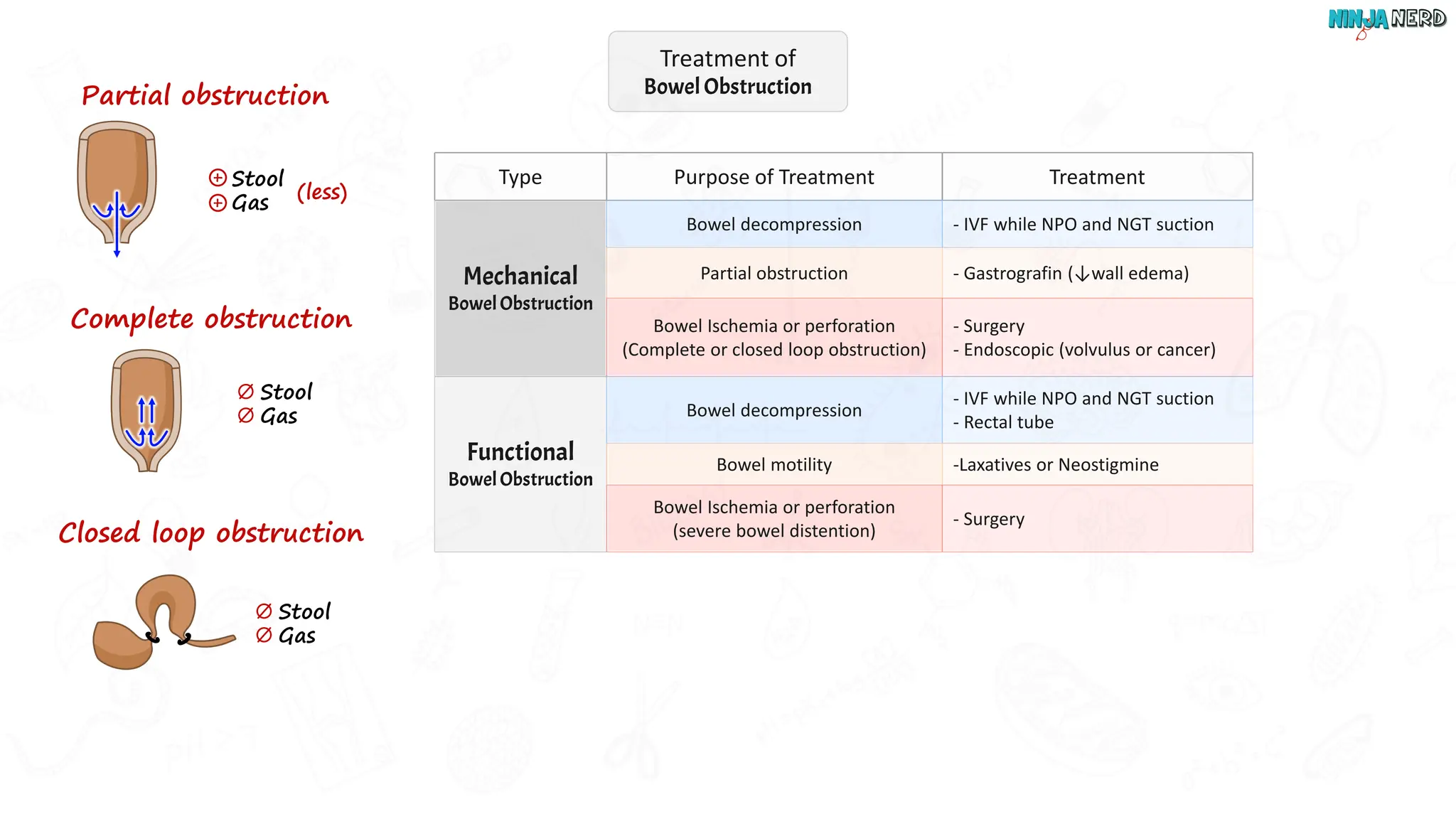 Gastro intestinal Bowel Obstruction [Slides].pdf