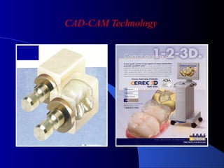 DENTAL CERAMICS Dental Porcelain All-CERAMIC RESTORATIONS dental ...