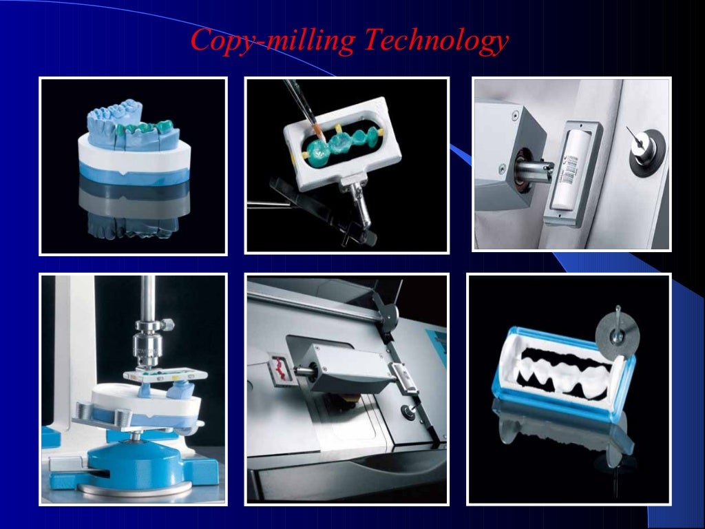 DENTAL CERAMICS Dental Porcelain AllCERAMIC RESTORATIONS dental mate…