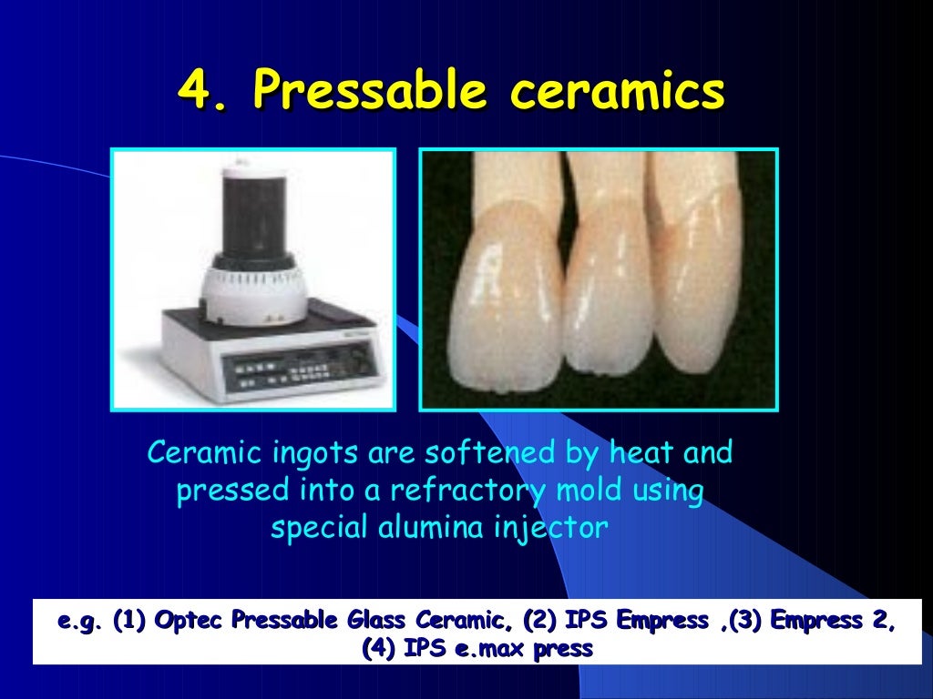 DENTAL CERAMICS Dental Porcelain AllCERAMIC RESTORATIONS dental mate…