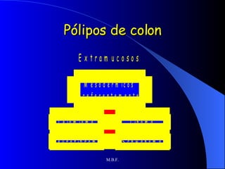 Pólipos de colon 
