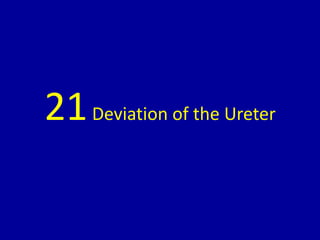 21Deviation of the Ureter
 