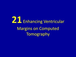 21Enhancing Ventricular
Margins on Computed
Tomography
 