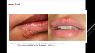 INVASÃO E INFECÇÃO
 