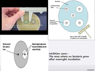 PRACTICAL antibiotic sensitivity test | PPT