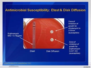 PRACTICAL antibiotic sensitivity test | PPT