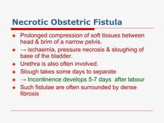 Necrotic Obstetric Fistula
   Prolonged compression of soft tissues between
    head & brim of a narrow pelvis.
   → ischaemia, pressure necrosis & sloughing of
    base of the bladder.
   Urethra is also often involved.
   Slough takes some days to separate
   → Incontinence develops 5-7 days after labour
   Such fistulae are often surrounded by dense
    fibrosis
 