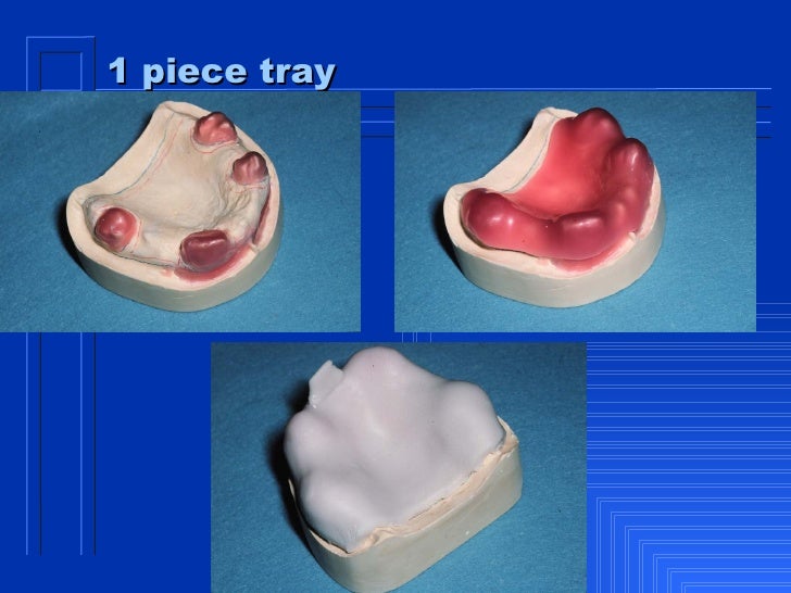 custom trays for dentures immediate denture custom trays for dentures immediate denture
